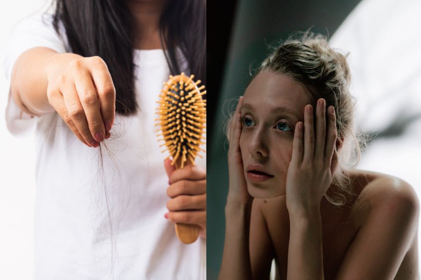 Ảnh 03. Tác hại của stress với sức khỏe da và tóc khiến nhiều nàng hoảng sợ